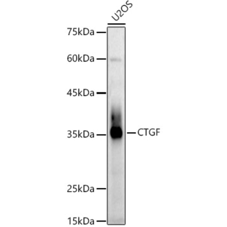 Western Blot - Anti-CTGF Antibody (A81045) - Antibodies.com