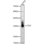 Western Blot - Anti-CTGF Antibody (A81045) - Antibodies.com