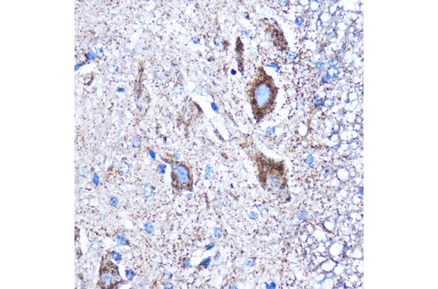 Immunohistochemistry - Anti-CTGF Antibody (A81045) - Antibodies.com