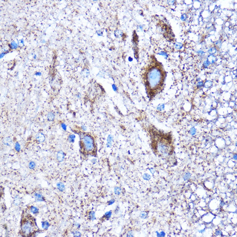 Immunohistochemistry - Anti-CTGF Antibody (A81045) - Antibodies.com