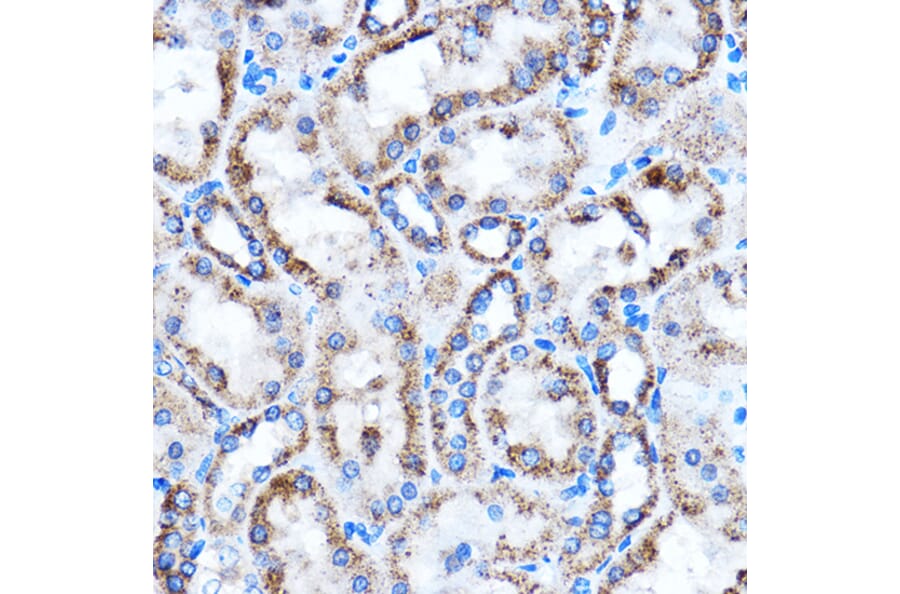 Immunohistochemistry - Anti-CTGF Antibody (A81045) - Antibodies.com