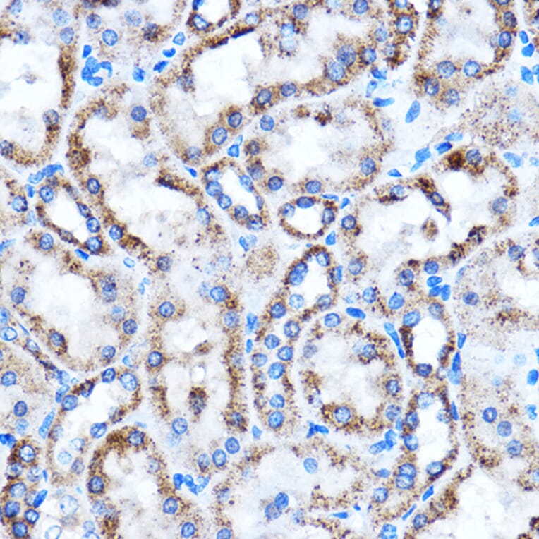 Immunohistochemistry - Anti-CTGF Antibody (A81045) - Antibodies.com