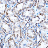 Immunohistochemistry - Anti-CTGF Antibody (A81045) - Antibodies.com