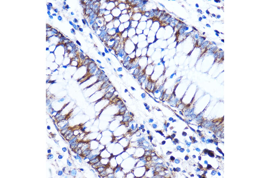 Immunohistochemistry - Anti-CTGF Antibody (A81045) - Antibodies.com