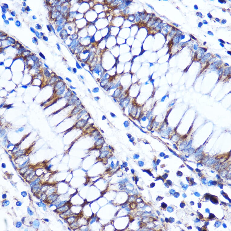 Immunohistochemistry - Anti-CTGF Antibody (A81045) - Antibodies.com