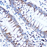 Immunohistochemistry - Anti-CTGF Antibody (A81045) - Antibodies.com