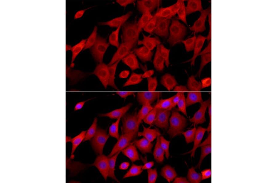 Immunofluorescence - Anti-CTGF Antibody (A81045) - Antibodies.com
