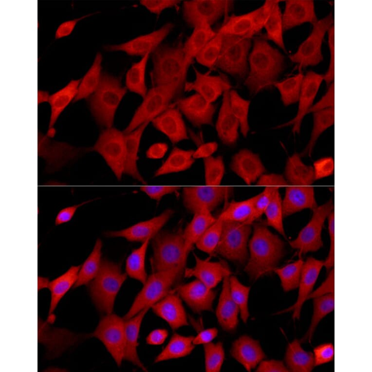 Immunofluorescence - Anti-CTGF Antibody (A81045) - Antibodies.com