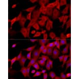 Immunofluorescence - Anti-CTGF Antibody (A81045) - Antibodies.com