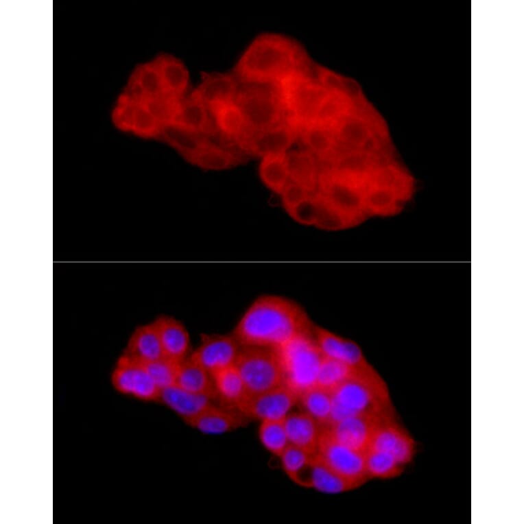 Immunofluorescence - Anti-CTGF Antibody (A81045) - Antibodies.com