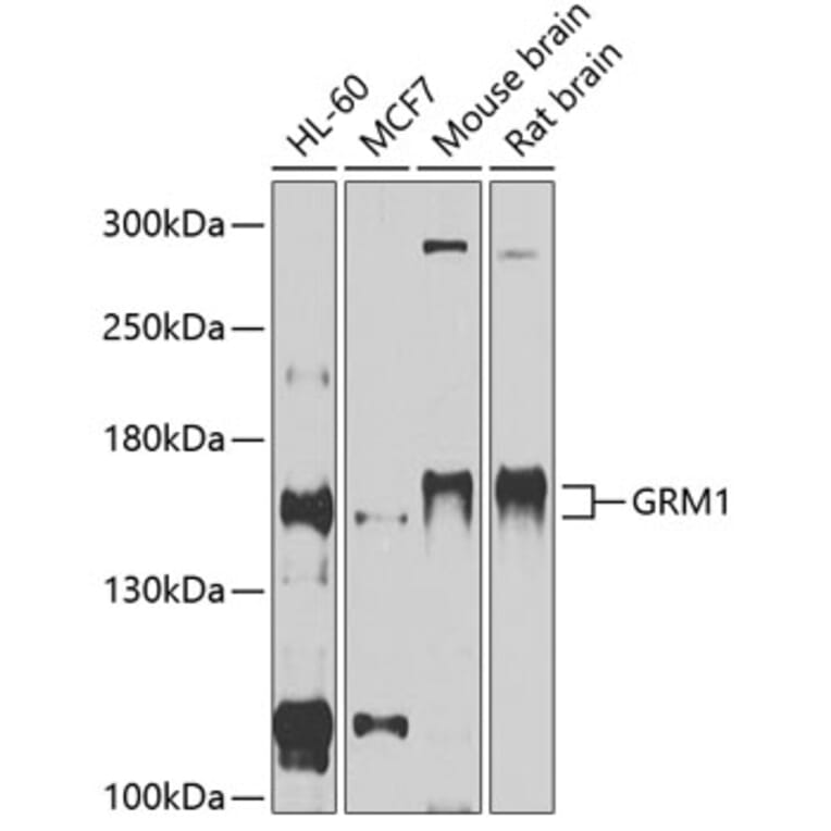 Western Blot - Anti-mGluR1a Antibody (A81046) - Antibodies.com