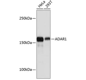 Western Blot - Anti-ADAR1 Antibody [ARC0602] (A81047) - Antibodies.com