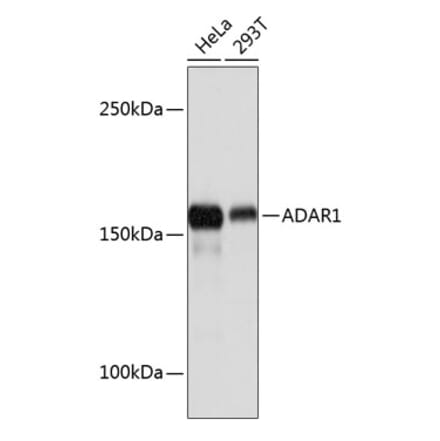 Western Blot - Anti-ADAR1 Antibody [ARC0602] (A81047) - Antibodies.com
