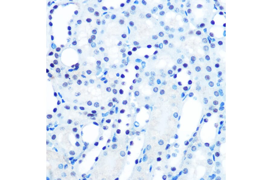 Immunohistochemistry - Anti-Mad2L1 Antibody [ARC0603] (A81048) - Antibodies.com