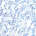 Immunohistochemistry - Anti-Mad2L1 Antibody [ARC0603] (A81048) - Antibodies.com