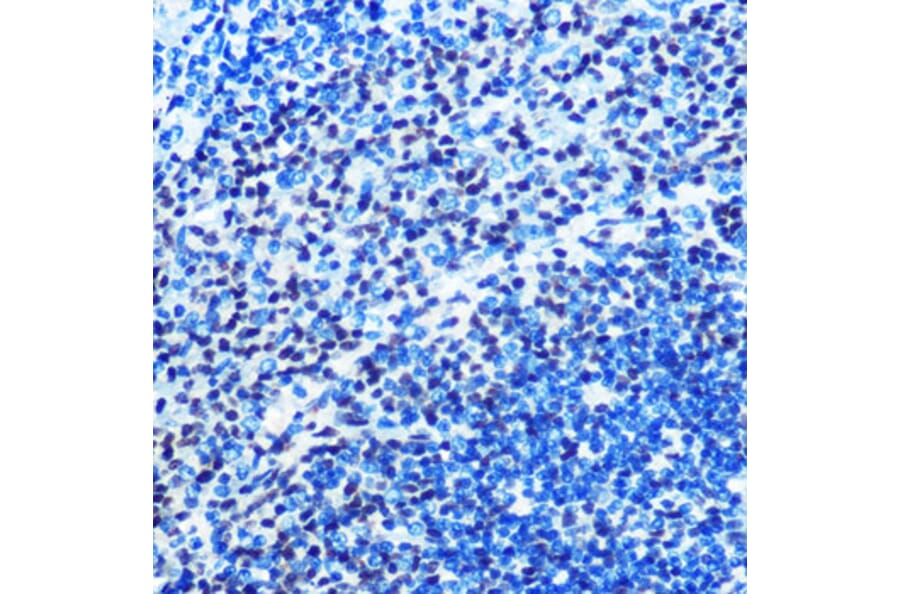 Immunohistochemistry - Anti-Mad2L1 Antibody [ARC0603] (A81048) - Antibodies.com