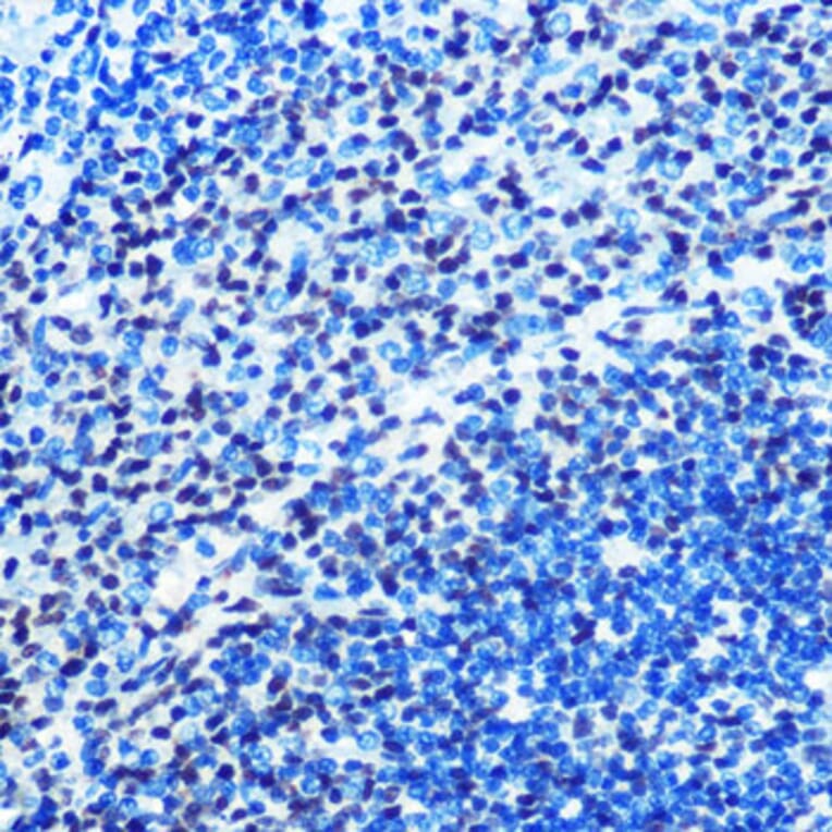 Immunohistochemistry - Anti-Mad2L1 Antibody [ARC0603] (A81048) - Antibodies.com