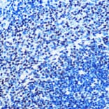 Immunohistochemistry - Anti-Mad2L1 Antibody [ARC0603] (A81048) - Antibodies.com