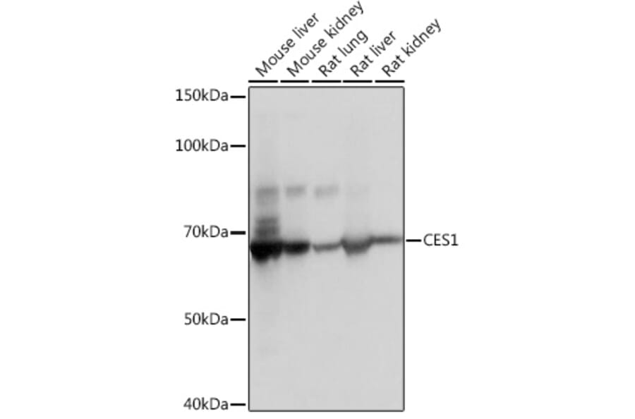Western Blot - Anti-Liver Carboxylesterase 1/CES1 Antibody [ARC0613] (A81049) - Antibodies.com