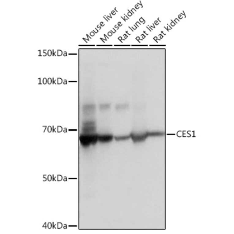 Western Blot - Anti-Liver Carboxylesterase 1/CES1 Antibody [ARC0613] (A81049) - Antibodies.com