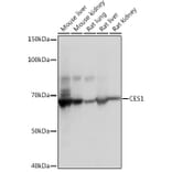 Western Blot - Anti-Liver Carboxylesterase 1/CES1 Antibody [ARC0613] (A81049) - Antibodies.com