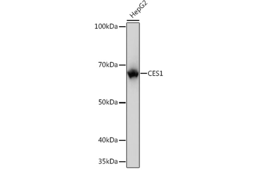 Western Blot - Anti-Liver Carboxylesterase 1/CES1 Antibody [ARC0613] (A81049) - Antibodies.com