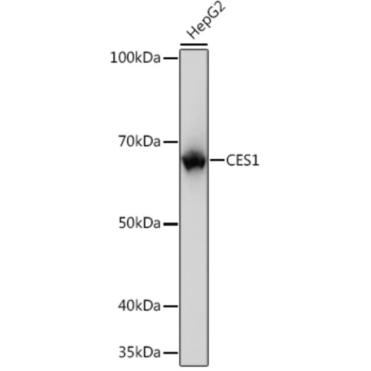 Western Blot - Anti-Liver Carboxylesterase 1/CES1 Antibody [ARC0613] (A81049) - Antibodies.com