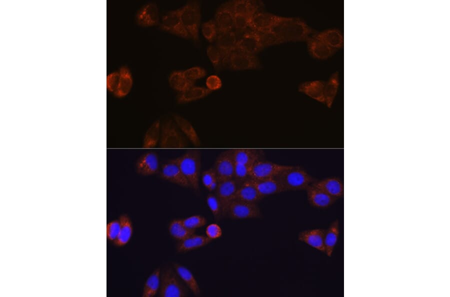 Immunofluorescence - Anti-Liver Carboxylesterase 1/CES1 Antibody [ARC0613] (A81049) - Antibodies.com