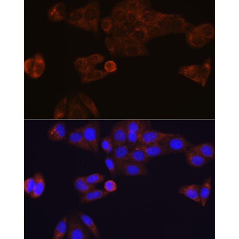 Immunofluorescence - Anti-Liver Carboxylesterase 1/CES1 Antibody [ARC0613] (A81049) - Antibodies.com