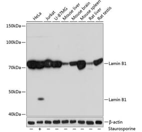 Western Blot - Anti-Lamin B1 Antibody [ARC0621] (A81050) - Antibodies.com