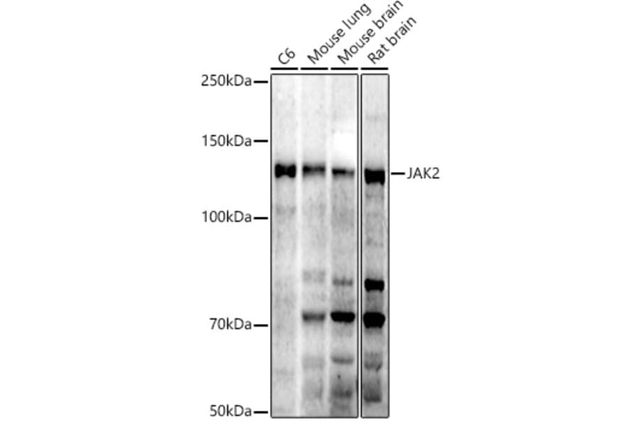Western Blot - Anti-JAK2 Antibody (A81051) - Antibodies.com