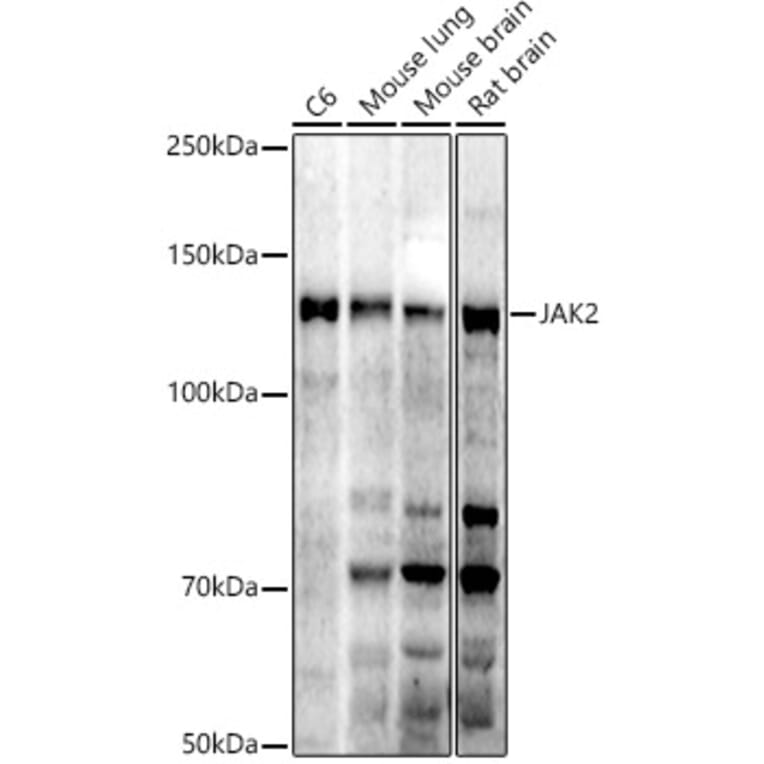 Western Blot - Anti-JAK2 Antibody (A81051) - Antibodies.com