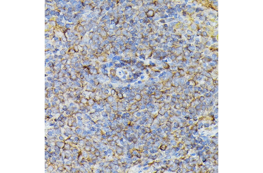Immunohistochemistry - Anti-JAK2 Antibody (A81051) - Antibodies.com