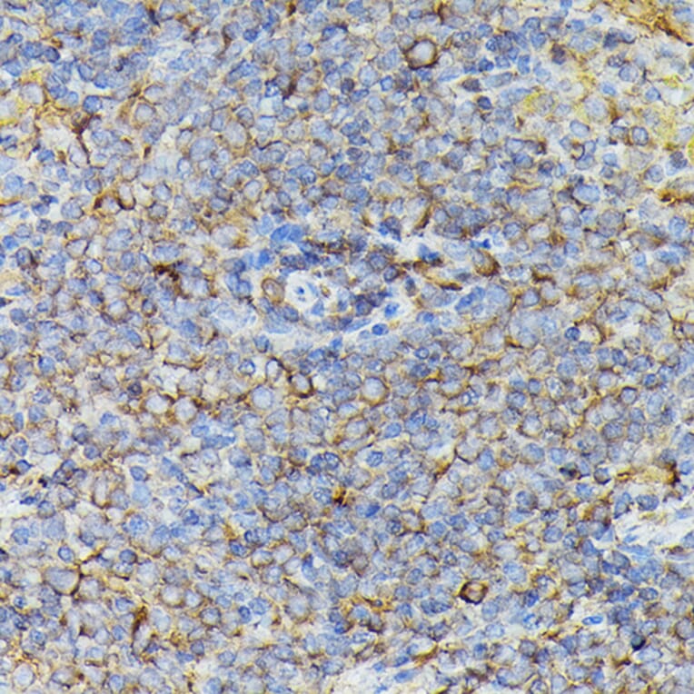 Immunohistochemistry - Anti-JAK2 Antibody (A81051) - Antibodies.com