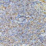 Immunohistochemistry - Anti-JAK2 Antibody (A81051) - Antibodies.com