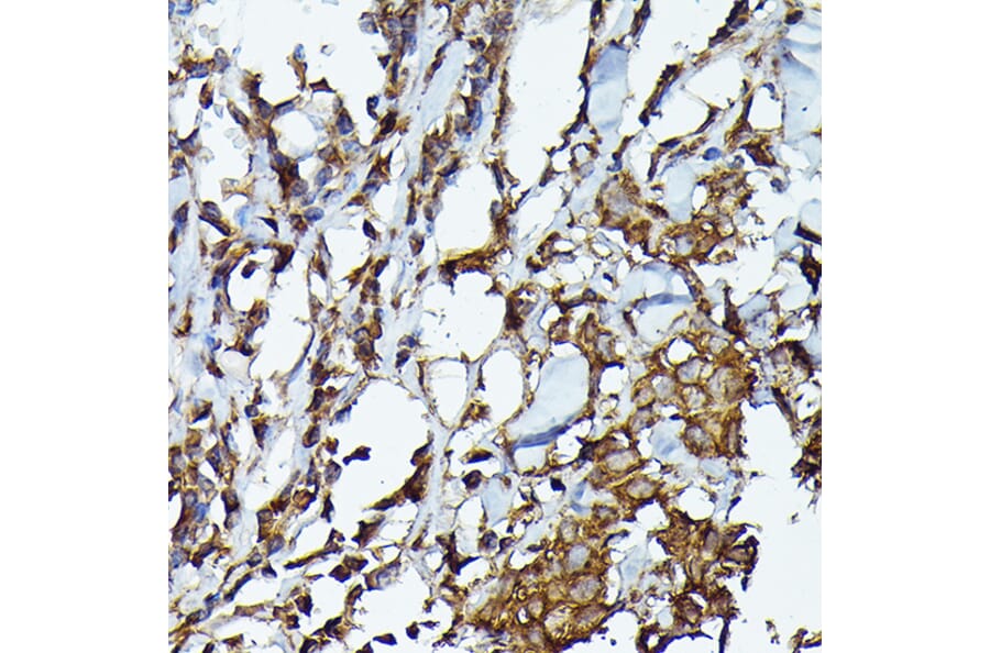 Immunohistochemistry - Anti-JAK2 Antibody (A81051) - Antibodies.com