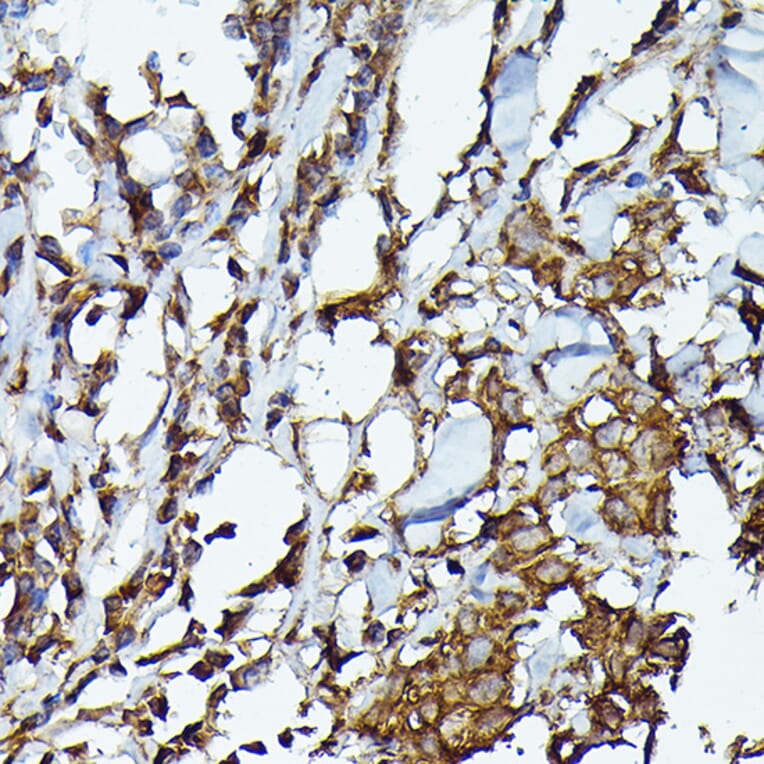 Immunohistochemistry - Anti-JAK2 Antibody (A81051) - Antibodies.com