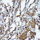 Immunohistochemistry - Anti-JAK2 Antibody (A81051) - Antibodies.com