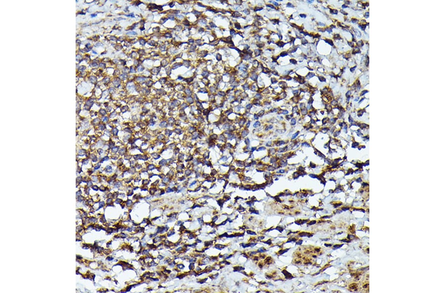 Immunohistochemistry - Anti-JAK2 Antibody (A81051) - Antibodies.com