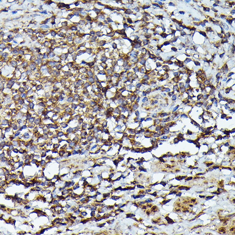 Immunohistochemistry - Anti-JAK2 Antibody (A81051) - Antibodies.com