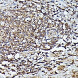 Immunohistochemistry - Anti-JAK2 Antibody (A81051) - Antibodies.com