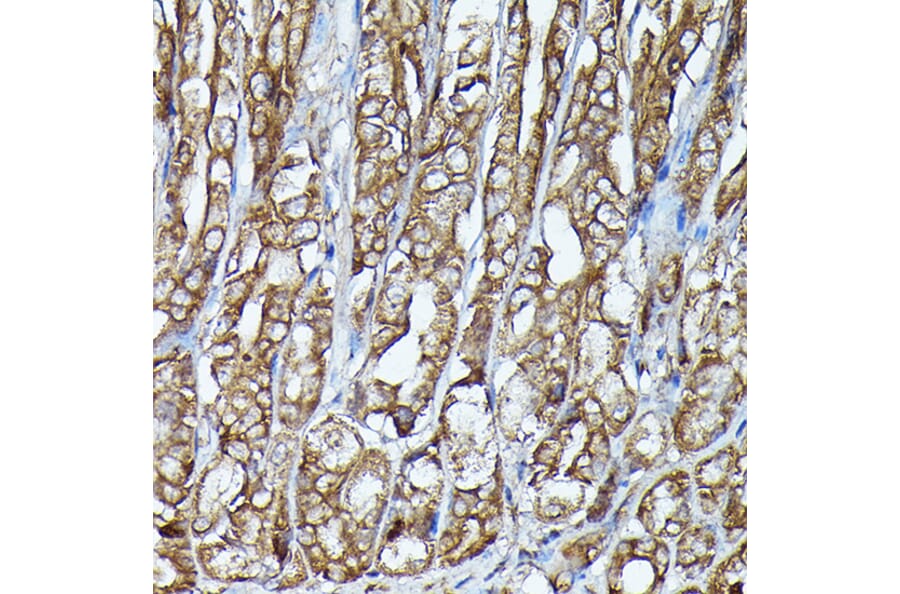 Immunohistochemistry - Anti-JAK2 Antibody (A81051) - Antibodies.com