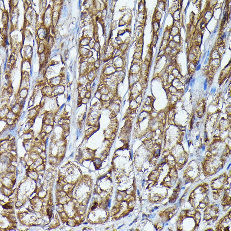 Immunohistochemistry - Anti-JAK2 Antibody (A81051) - Antibodies.com