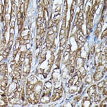 Immunohistochemistry - Anti-JAK2 Antibody (A81051) - Antibodies.com