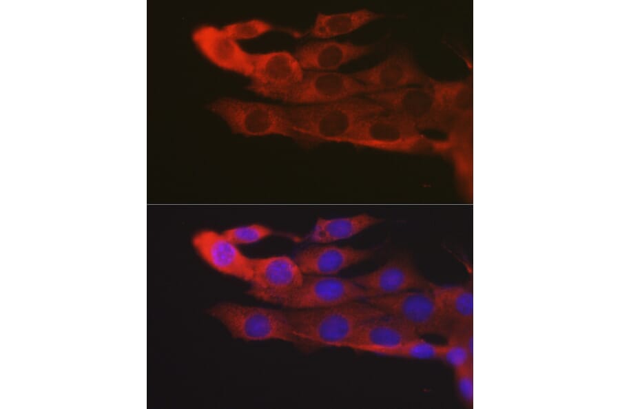Immunofluorescence - Anti-JAK2 Antibody (A81051) - Antibodies.com