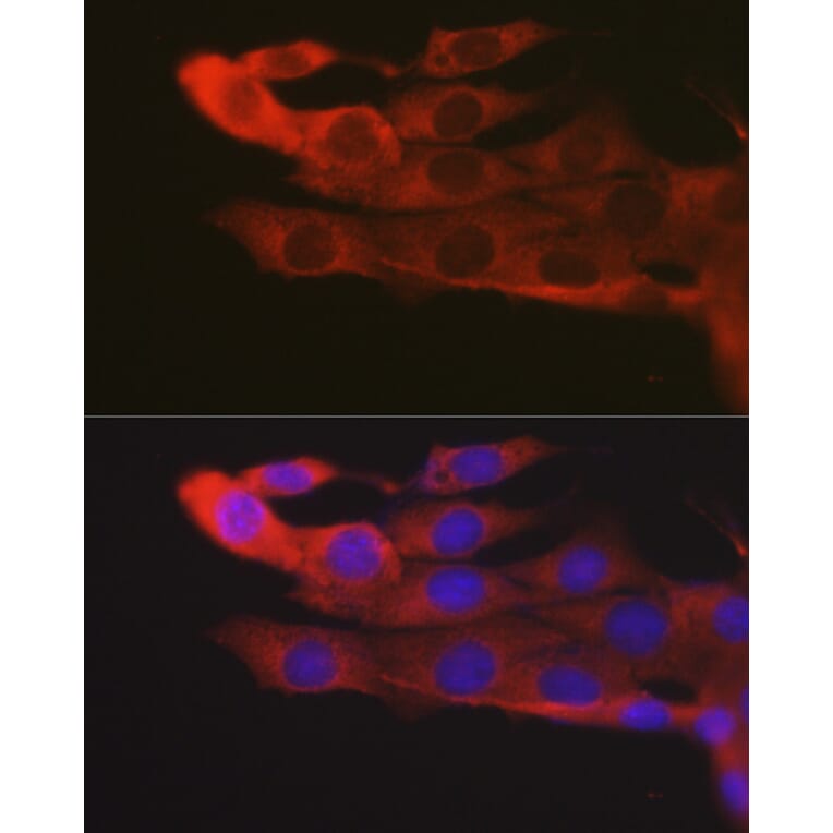 Immunofluorescence - Anti-JAK2 Antibody (A81051) - Antibodies.com