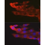 Immunofluorescence - Anti-JAK2 Antibody (A81051) - Antibodies.com