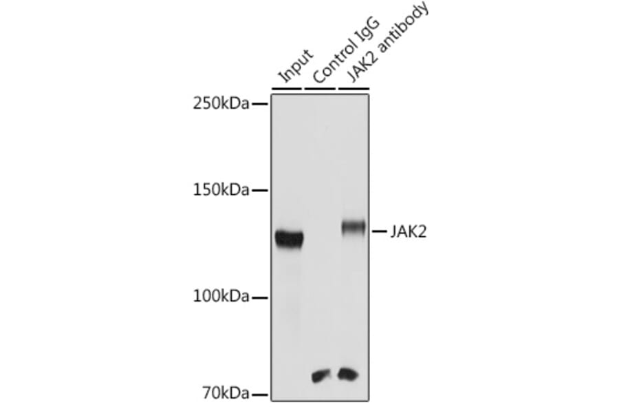 Western Blot - Anti-JAK2 Antibody (A81051) - Antibodies.com