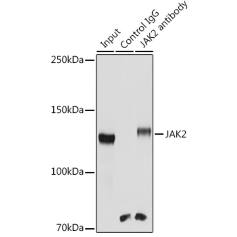 Western Blot - Anti-JAK2 Antibody (A81051) - Antibodies.com