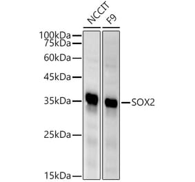 Western Blot - Anti-SOX2 Antibody (A81052) - Antibodies.com